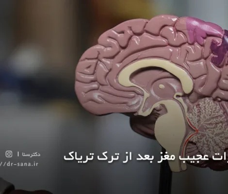 تغییرات عجیب مغز بعد از ترک تریاک