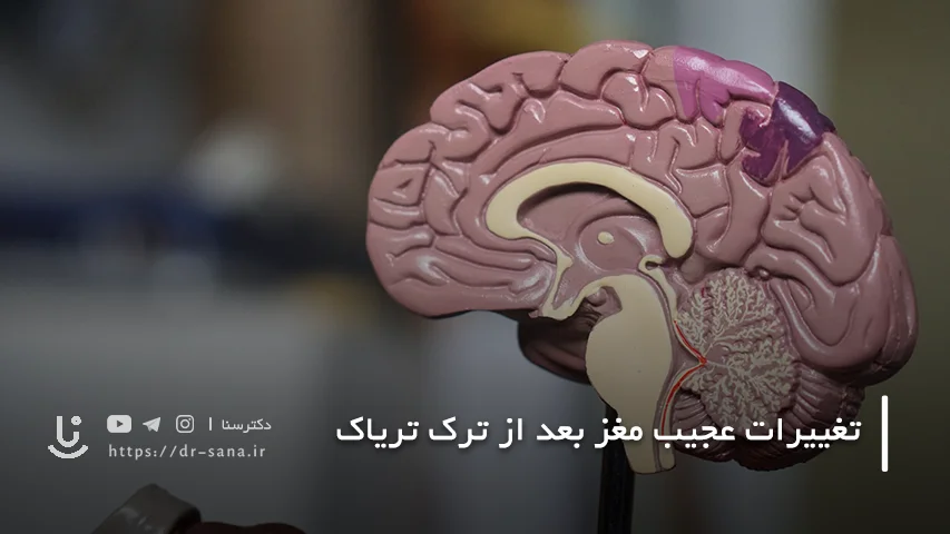 تغییرات عجیب مغز بعد از ترک تریاک